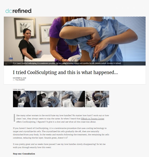 DC Refined, tried Coolsculpting and here is what happened&#8230;
